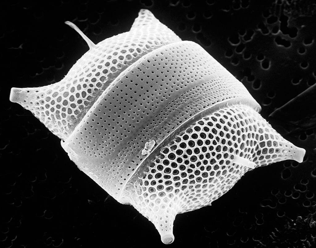 Image of Odontella diatoms found in Washingtons coastal waters.